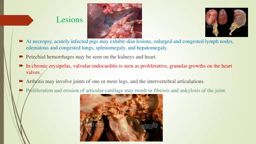 lesions