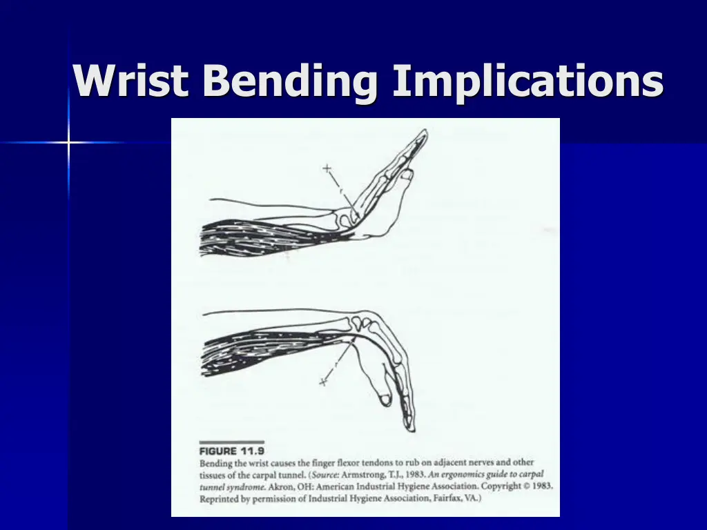 wrist bending implications