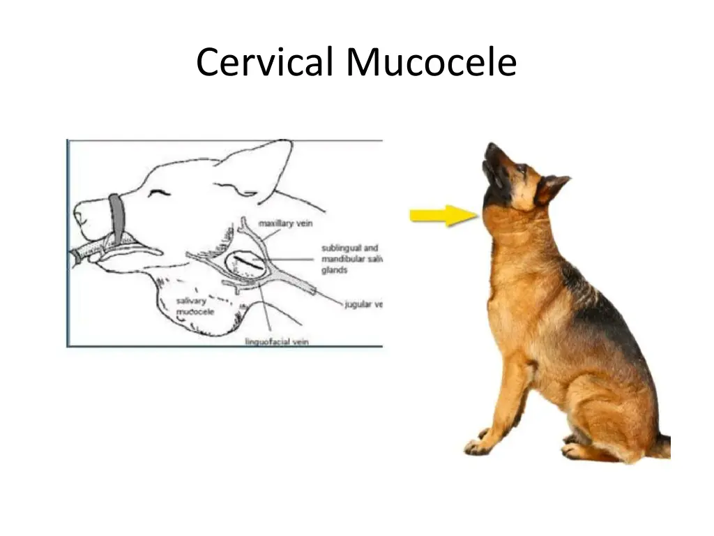 cervical mucocele