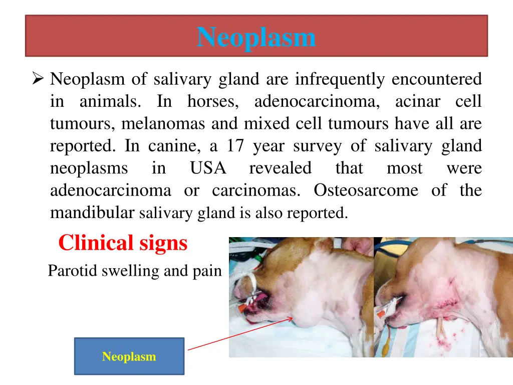 neoplasm