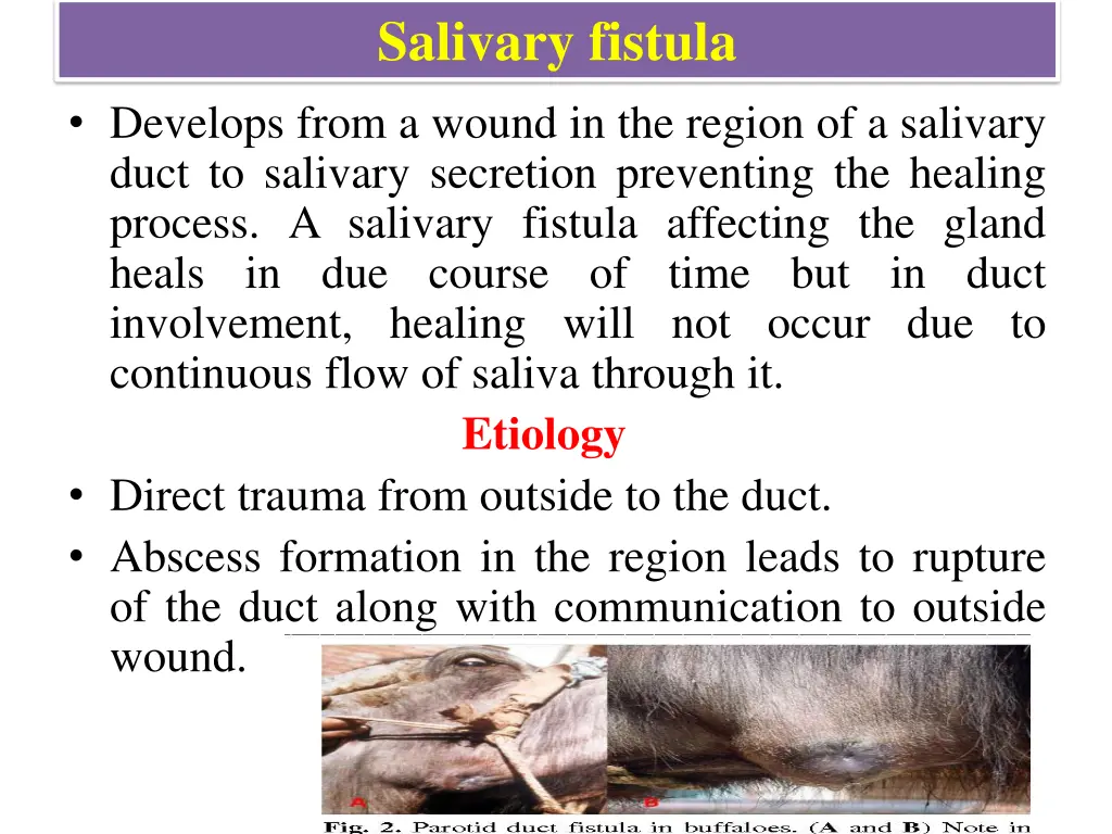 salivary fistula