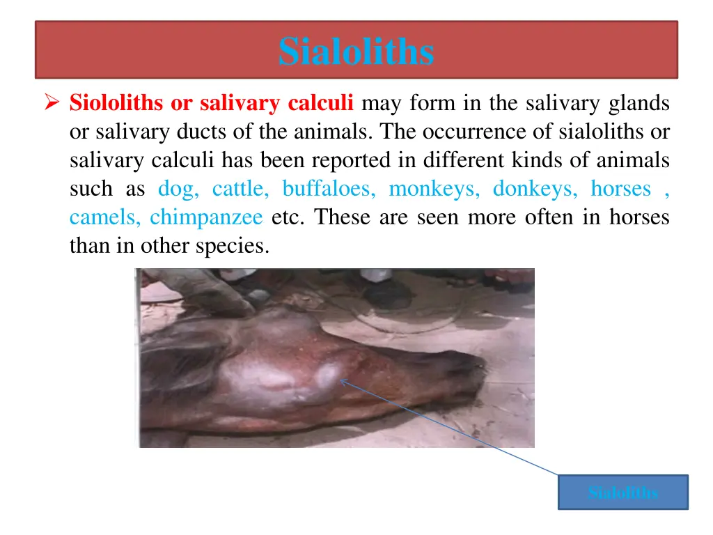 sialoliths