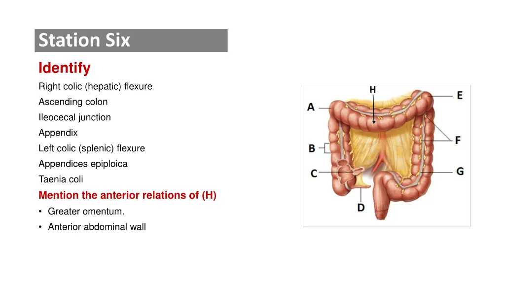 station six identify right colic hepatic flexure