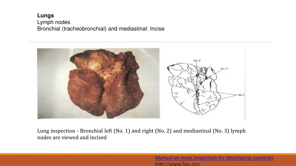 lungs lymph nodes bronchial tracheobronchial