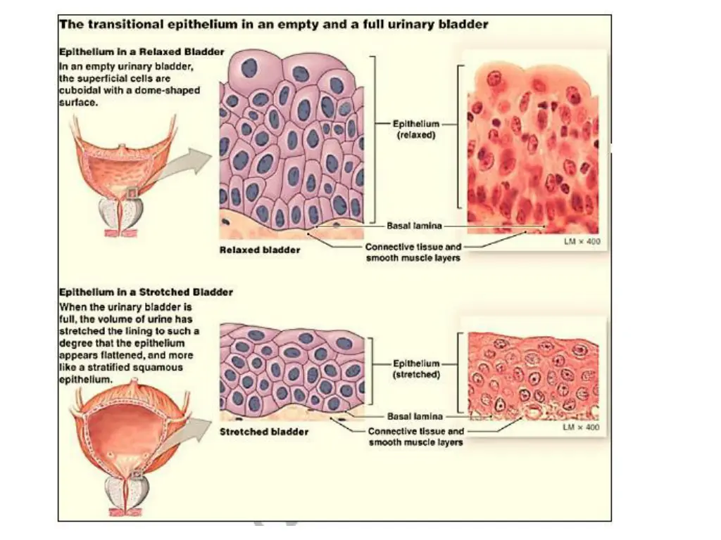 slide12