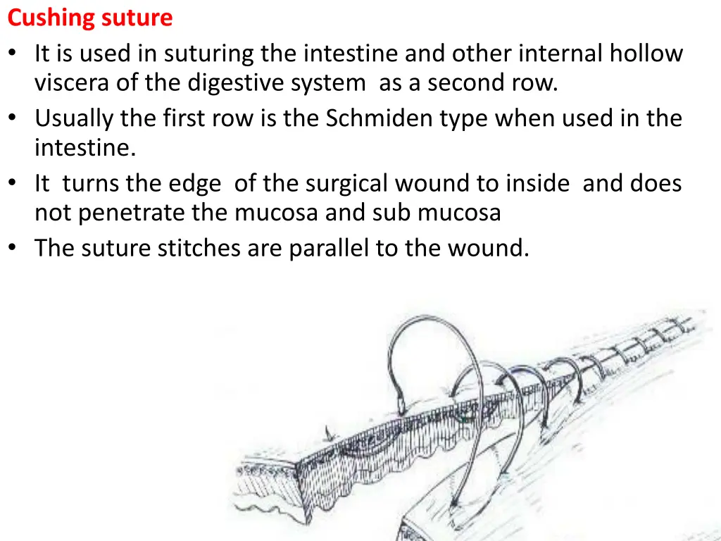 cushing suture it is used in suturing