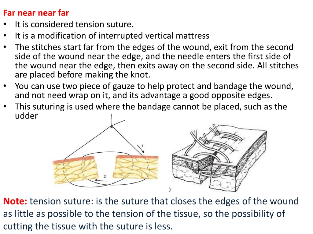 far near near far it is considered tension suture