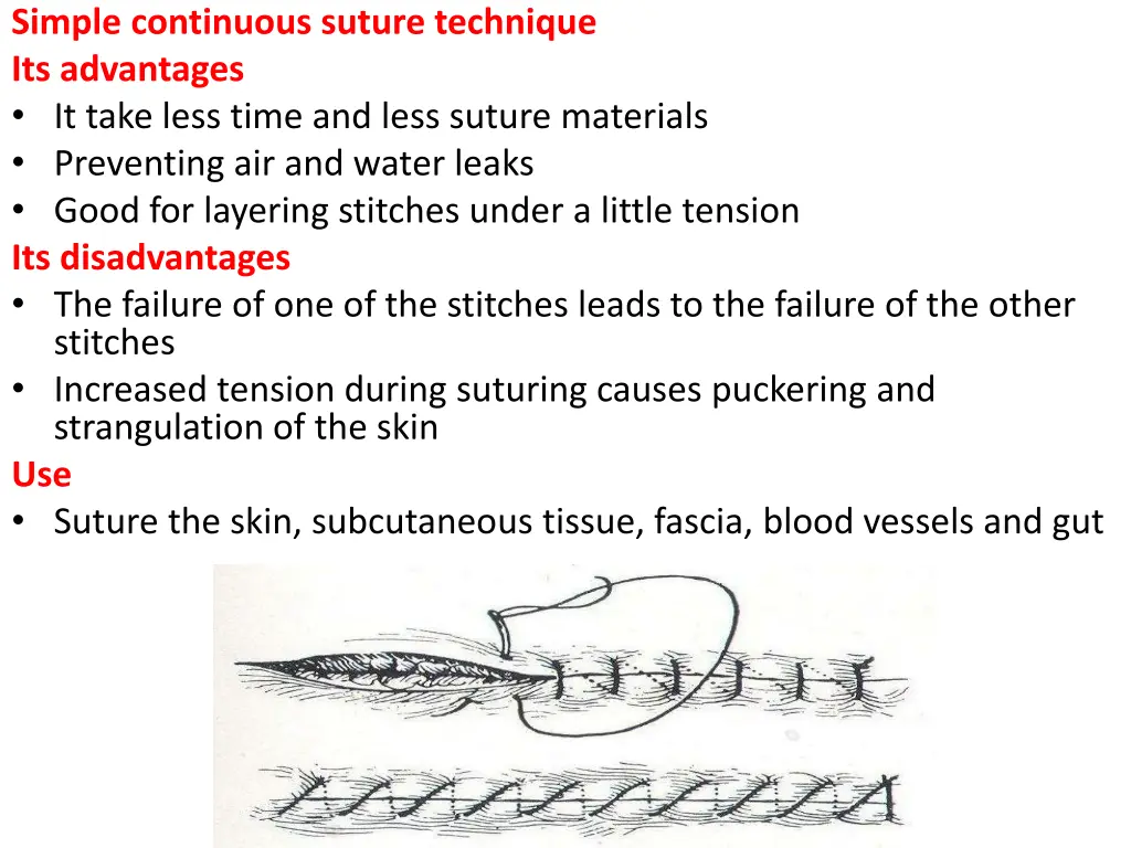 simple continuous suture technique its advantages