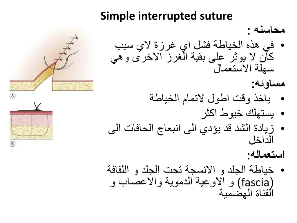 simple interrupted suture