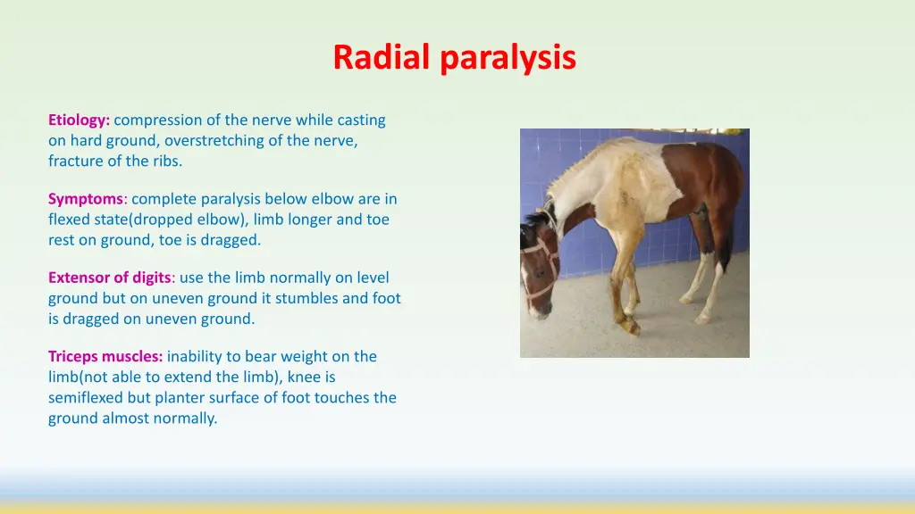 radial paralysis