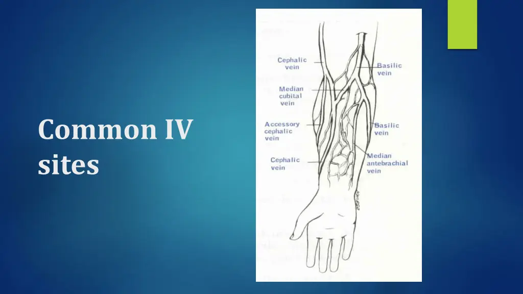 common iv sites