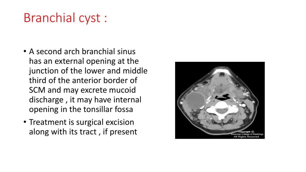 branchial cyst 1