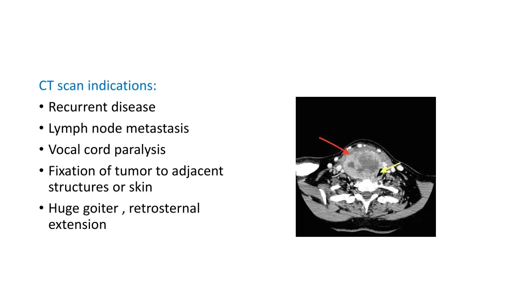 ct scan indications recurrent disease lymph node