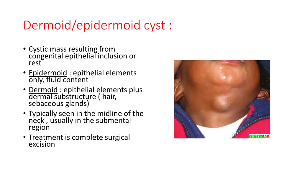 dermoid epidermoid cyst