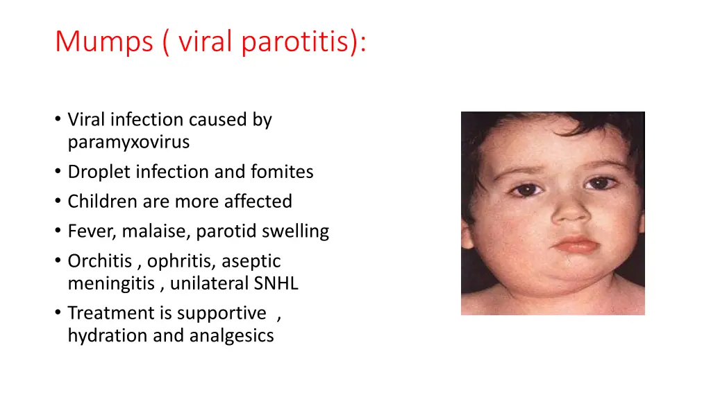 mumps viral parotitis