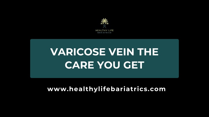 varicose vein the care you get