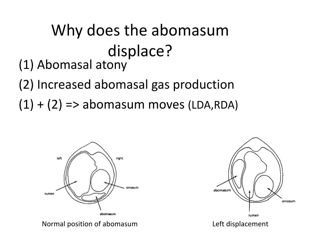 why does the abomasum displace 1 abomasal atony