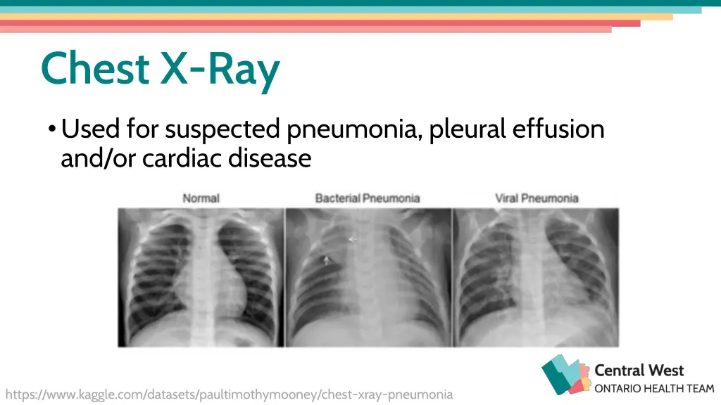 chest x ray