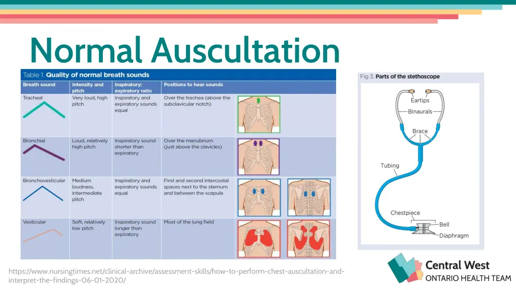 normal auscultation