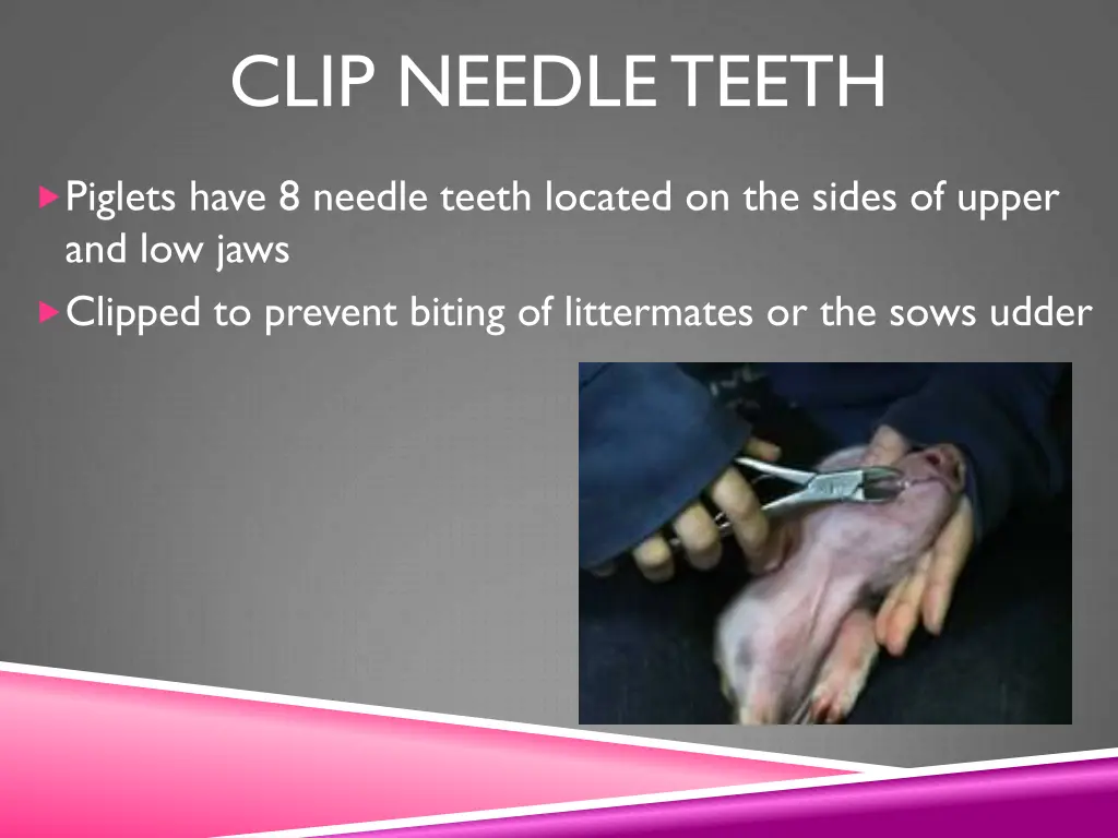 clip needle teeth