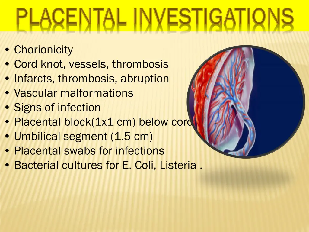 chorionicity cord knot vessels thrombosis