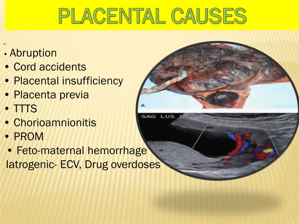 placental causes placental causes