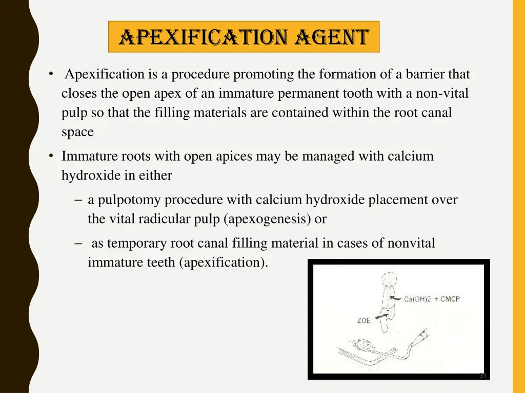 apexification agent