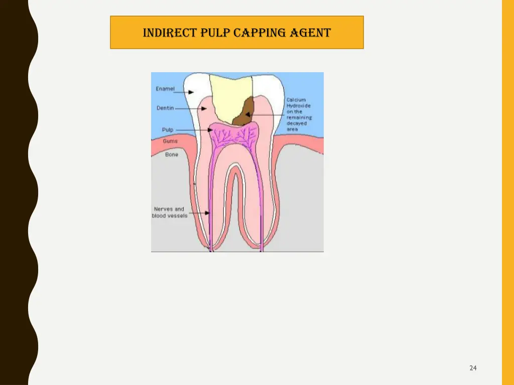 indirect pulp capping agent