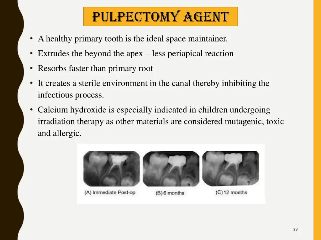 pulpectomy agent