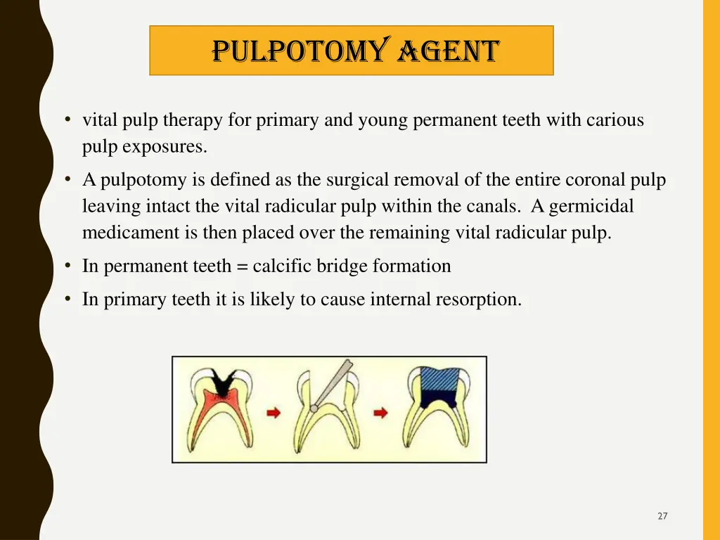 pulpotomy agent