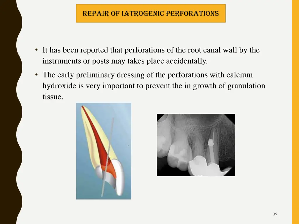 repair of iatrogenic perforations