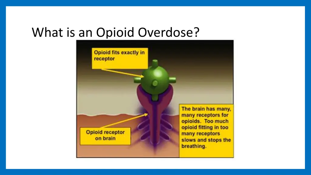 what is an opioid overdose