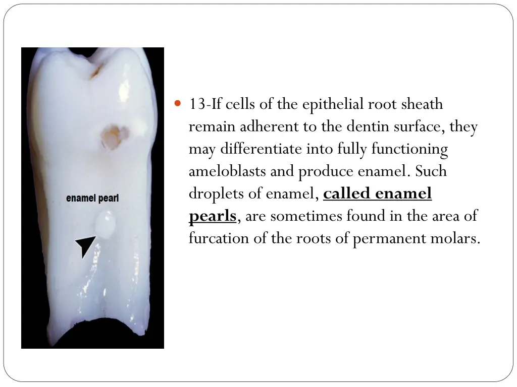 13 if cells of the epithelial root sheath remain