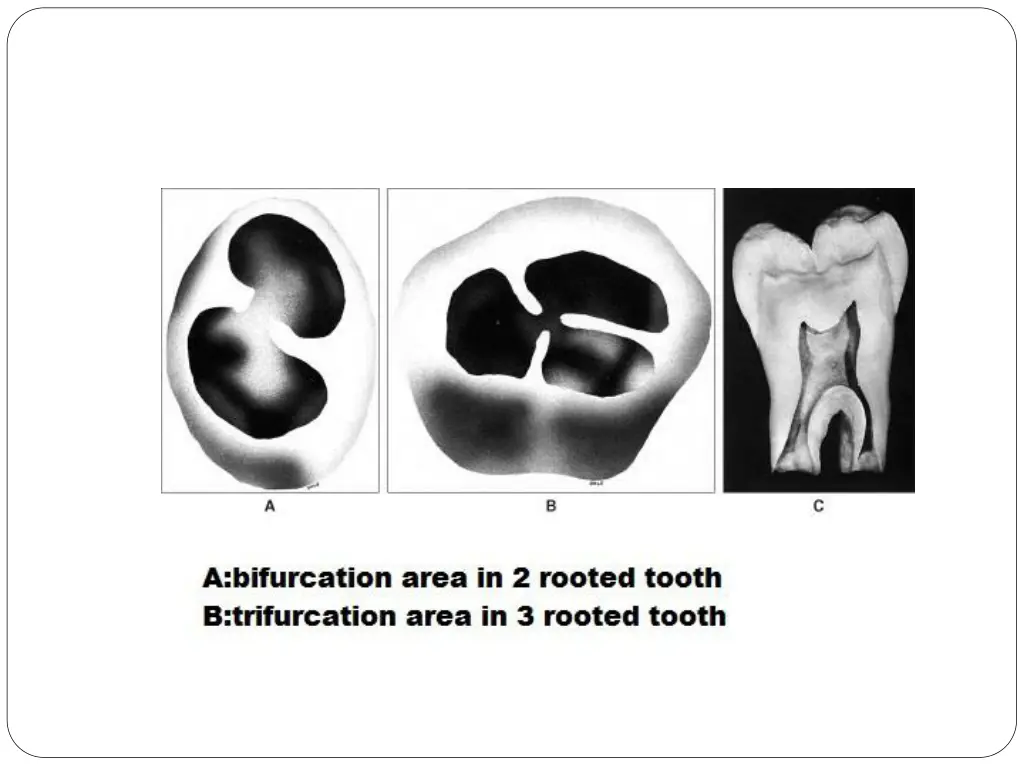 slide16