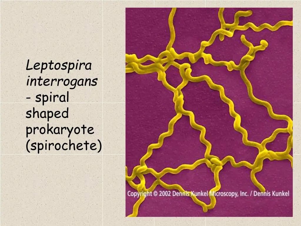 leptospira interrogans spiral shaped prokaryote