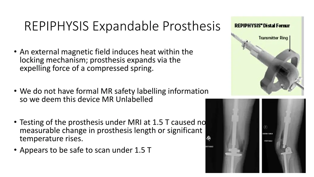 repiphysis expandable prosthesis 1