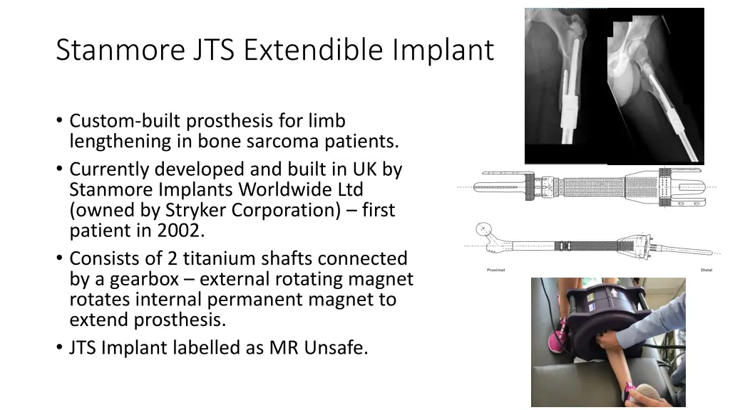 stanmore jts extendible implant