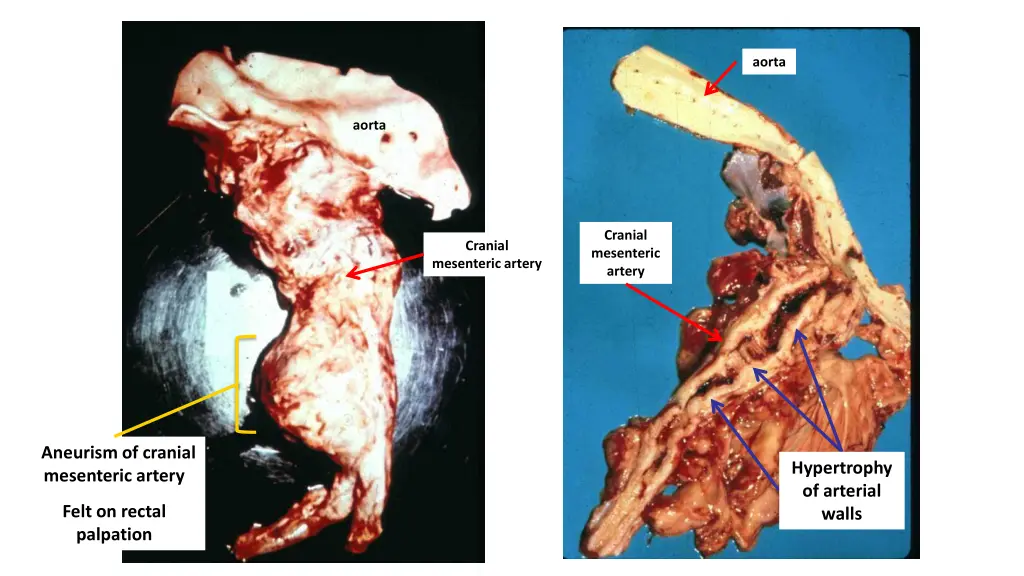 aorta