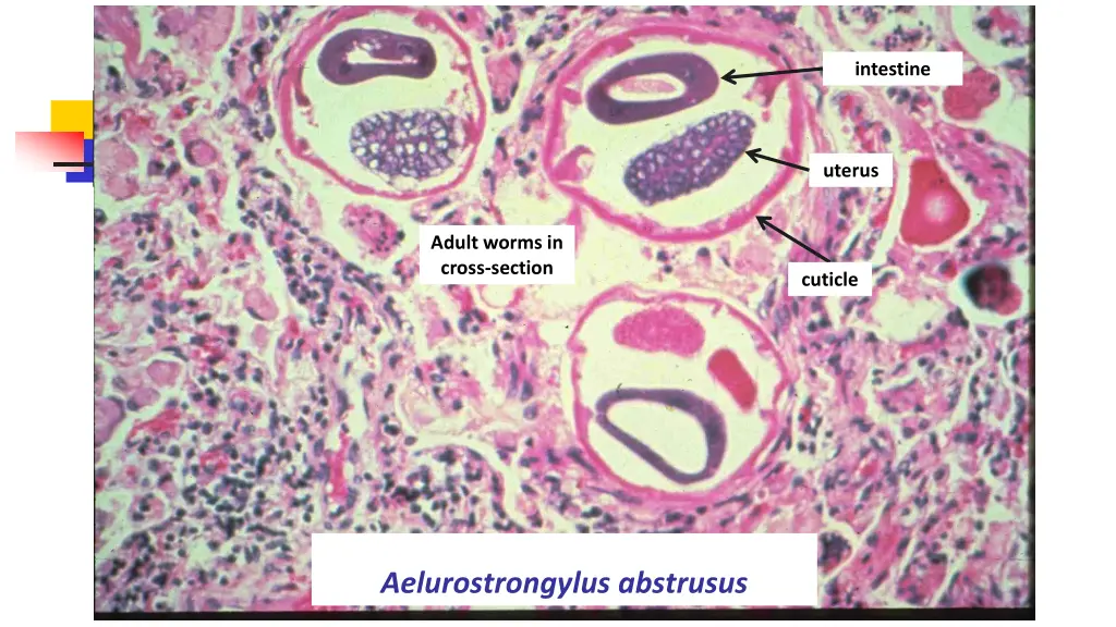 intestine