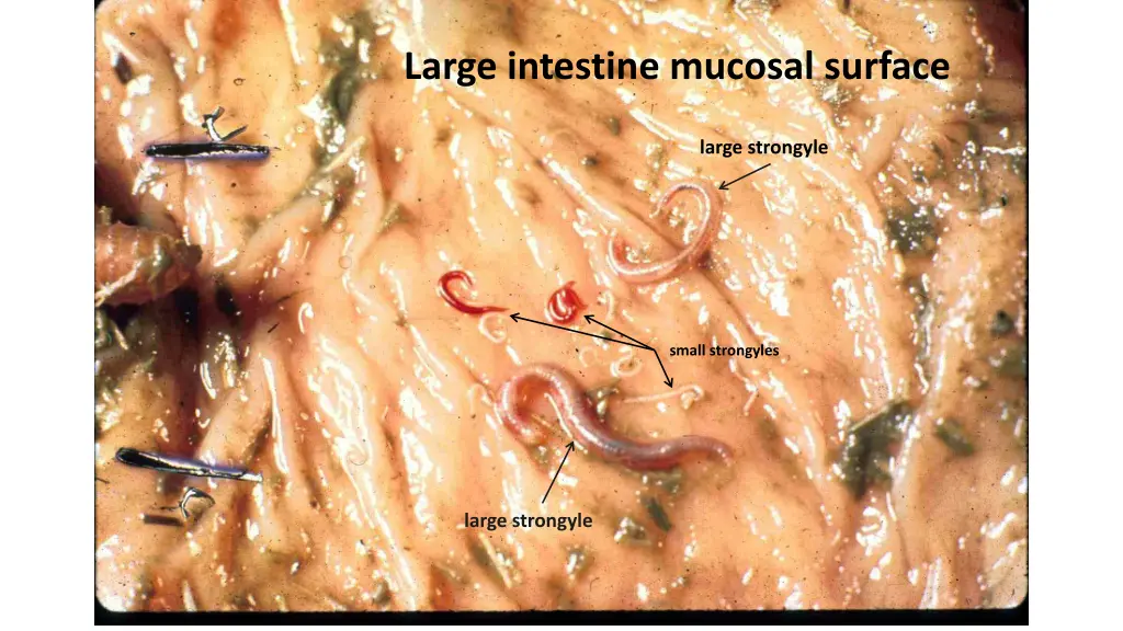 large intestine mucosal surface