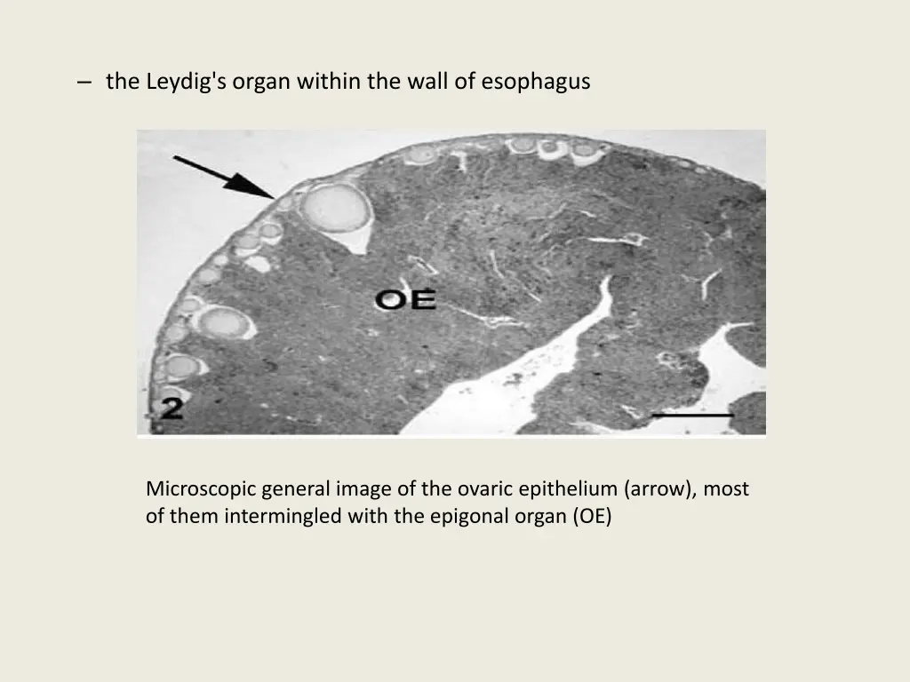 the leydig s organ within the wall of esophagus