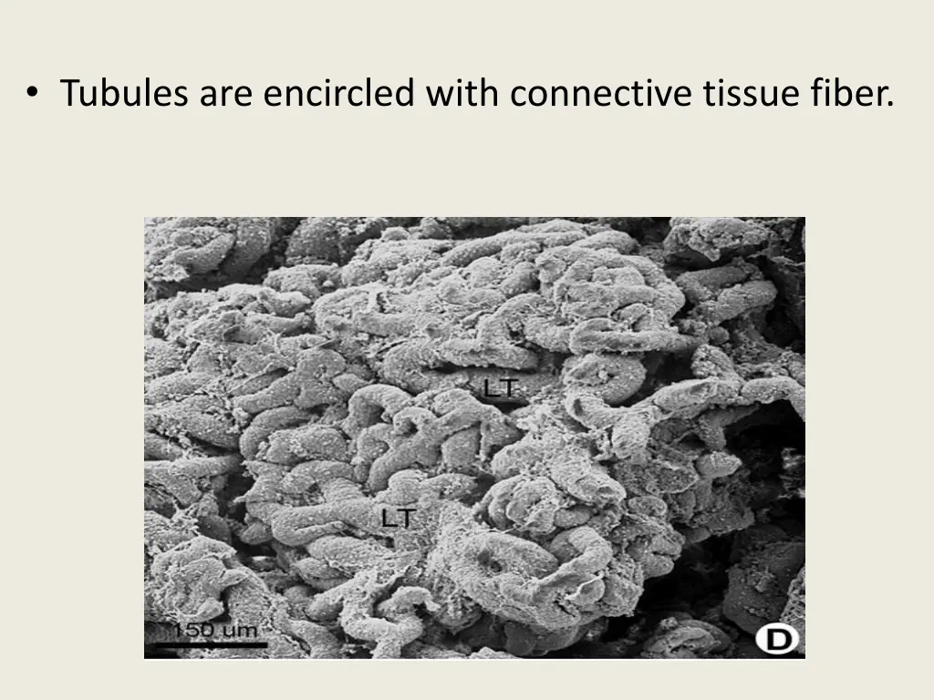 tubules are encircled with connective tissue fiber