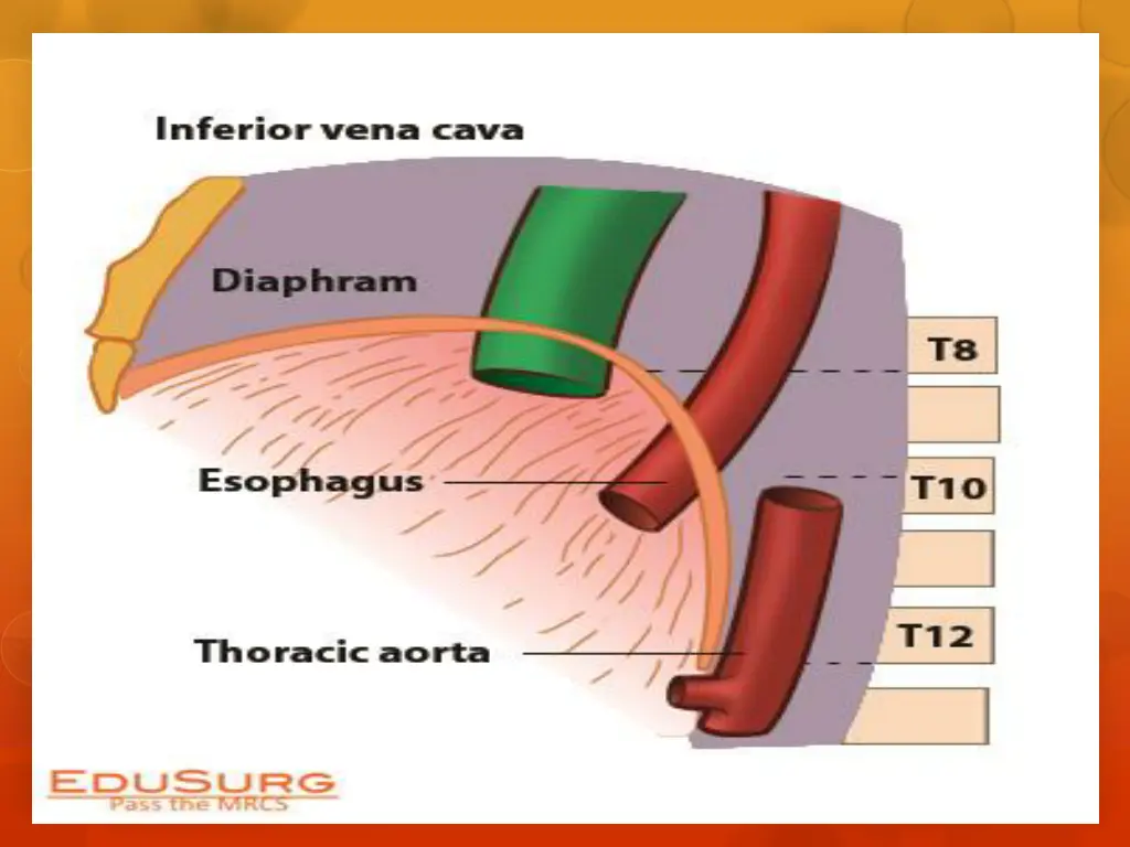 slide14