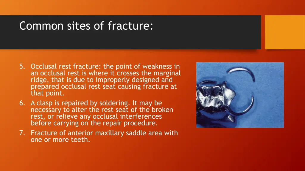 common sites of fracture 1