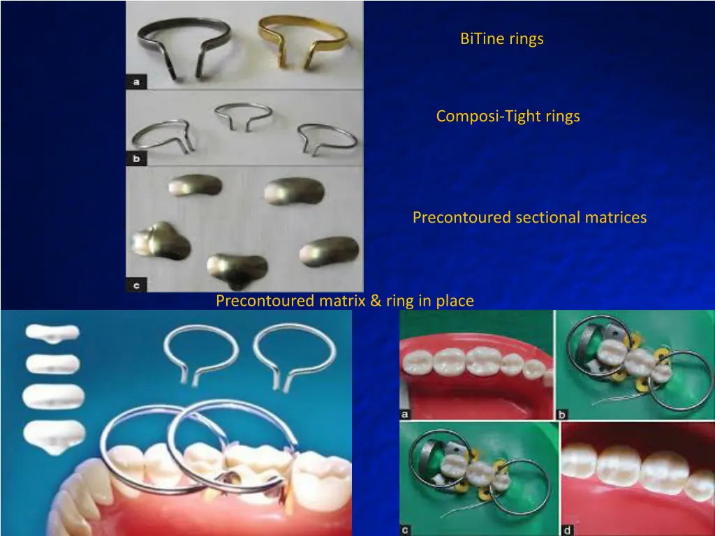 bitine rings