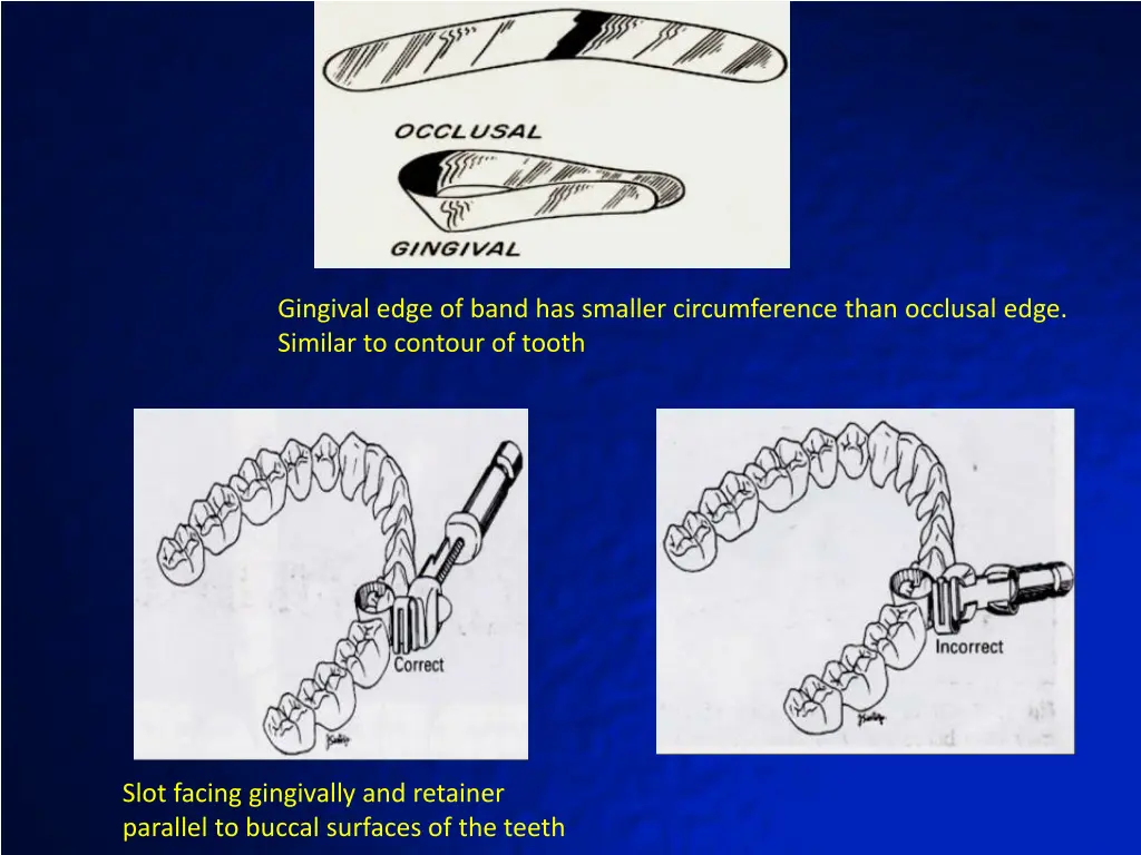 gingival edge of band has smaller circumference