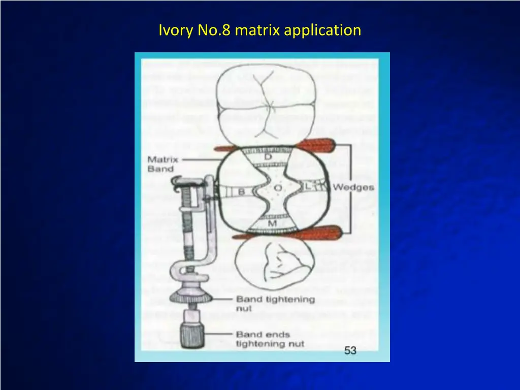 ivory no 8 matrix application