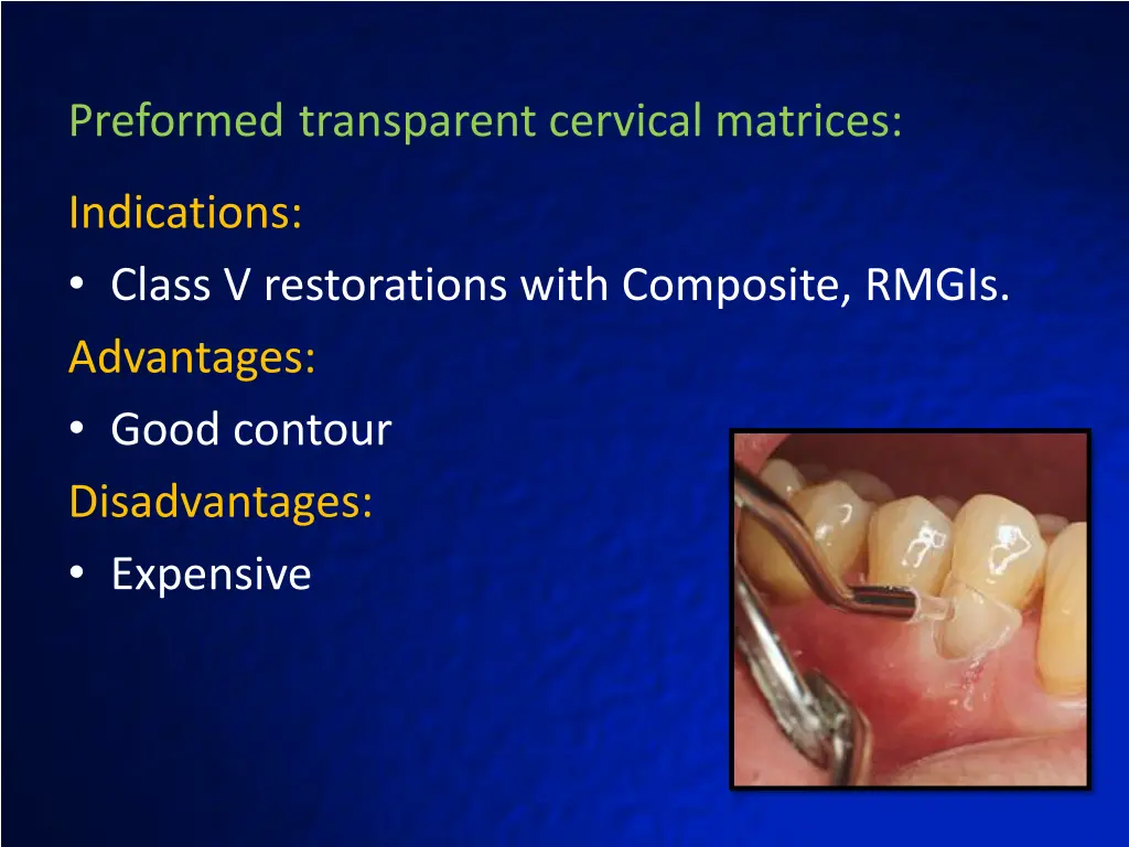 preformed transparent cervical matrices 1