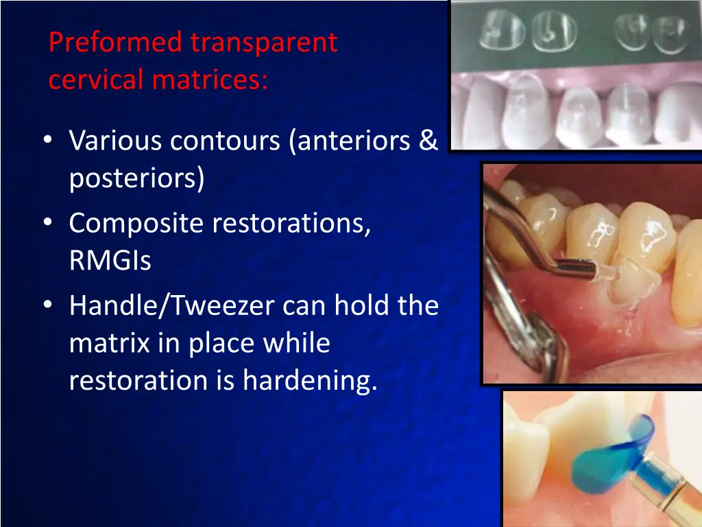 preformed transparent cervical matrices