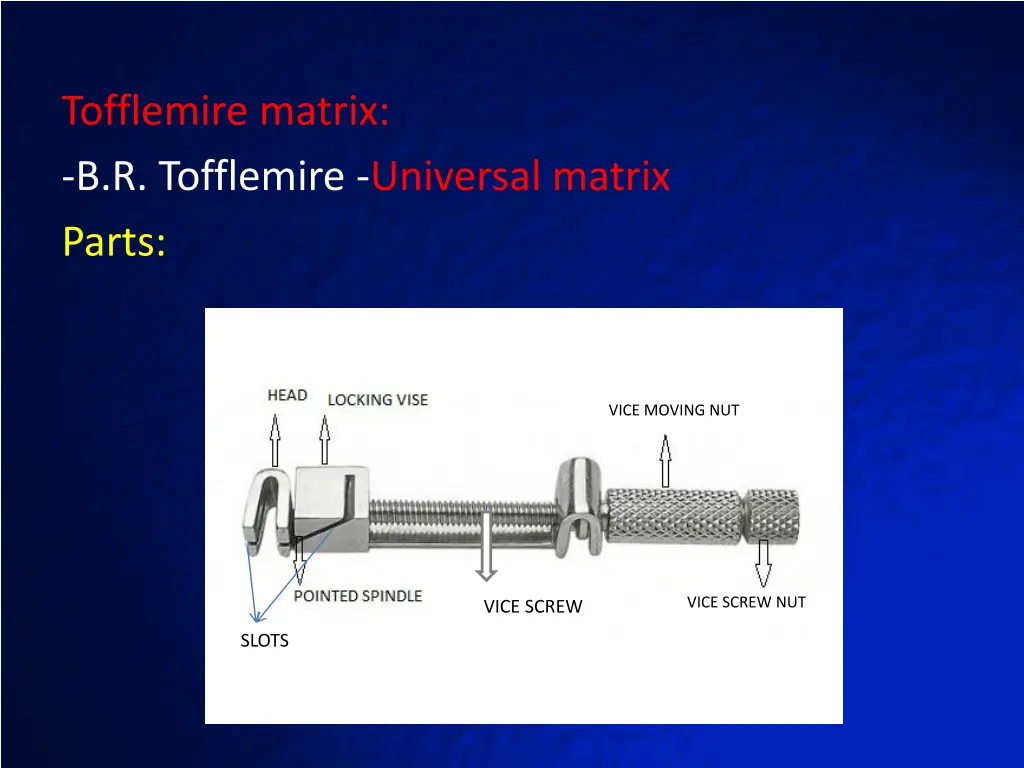 tofflemire matrix b r tofflemire universal matrix